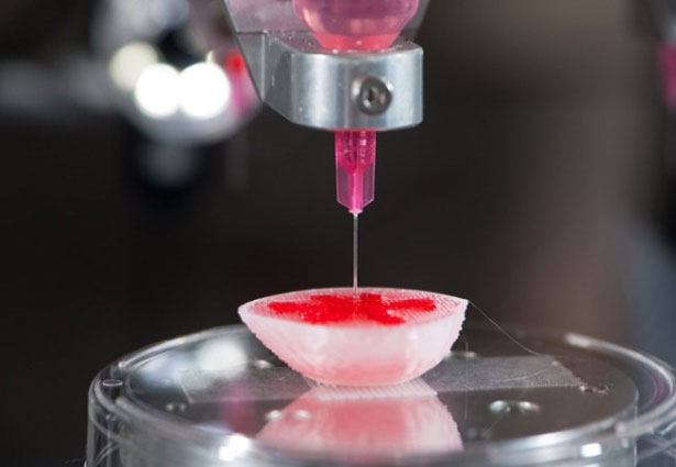 3D-Printing-Medical-Kidney
