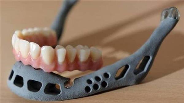 first-3d-printed-jaw